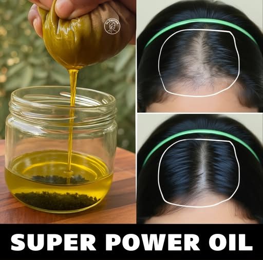 3 Best Hair Oils: Get Rid Of Baldness, Thin To Thick Hair, Extreme Hair Growth
